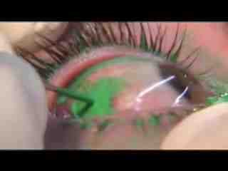 green eyeball tatto